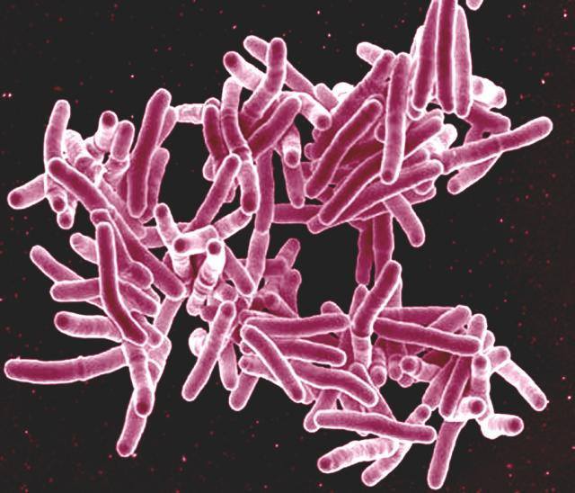 1994 – Determining general awareness of Tuberculosis